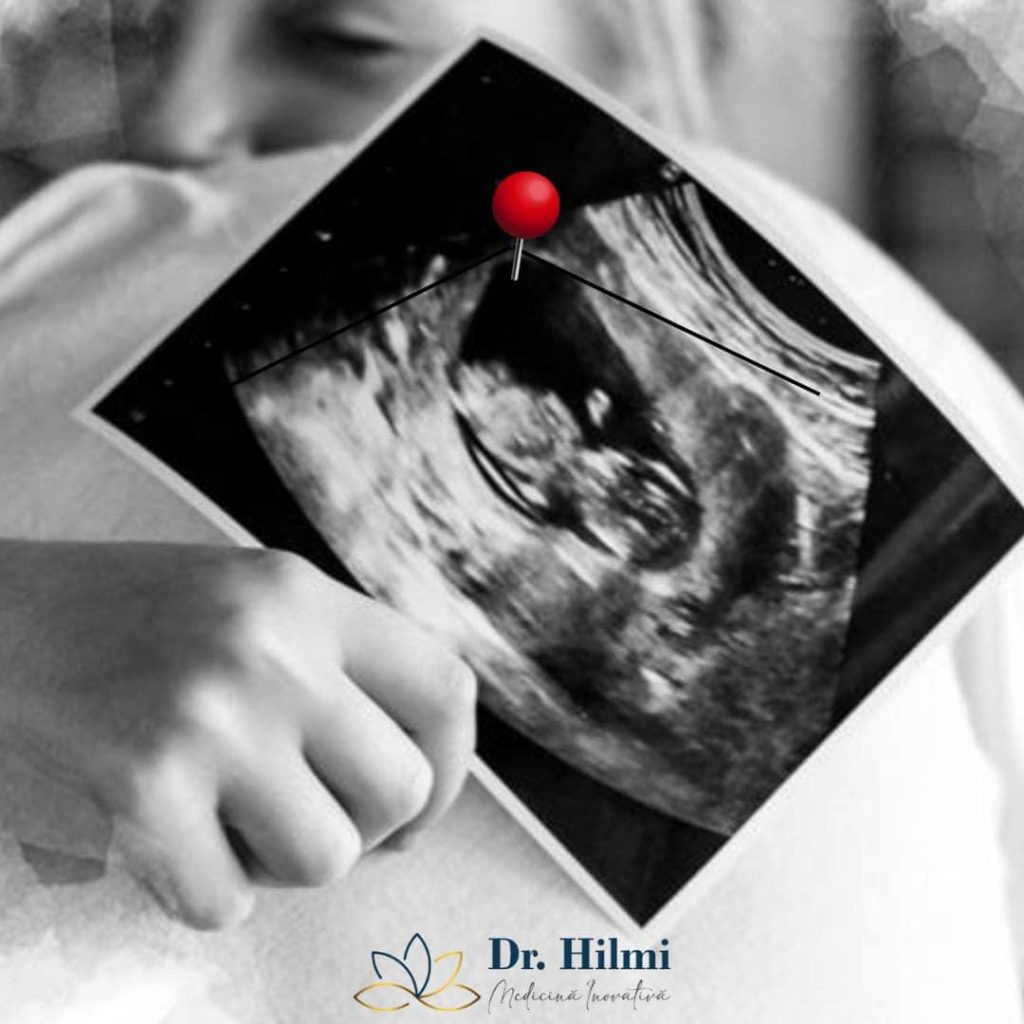 Histeroscopia, Dr. Hilmi Fertility Clinic, fertilitate